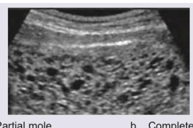 Image for question 917