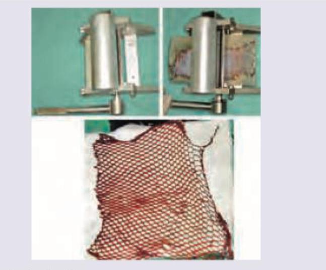 Image for question 166