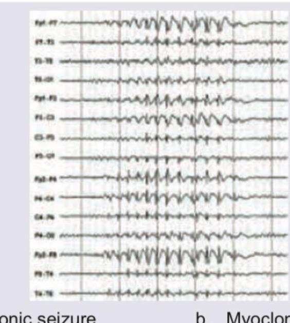 Image for question 35