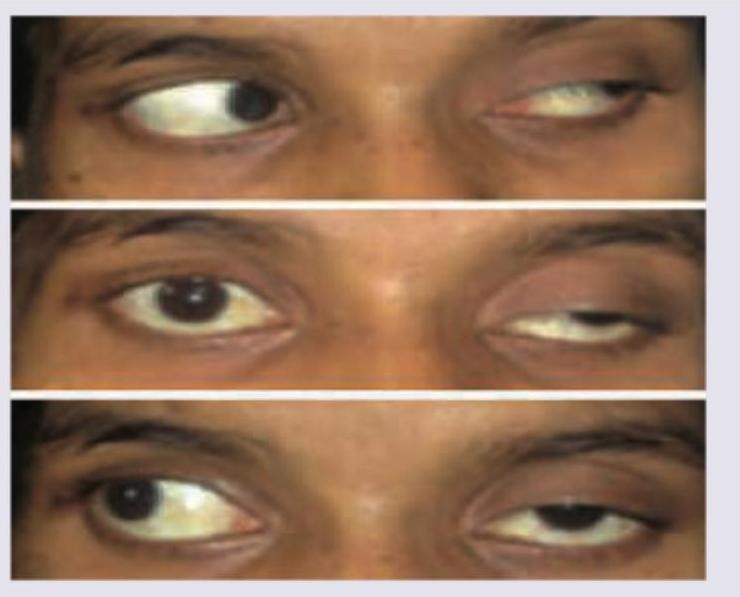 Image for question 1