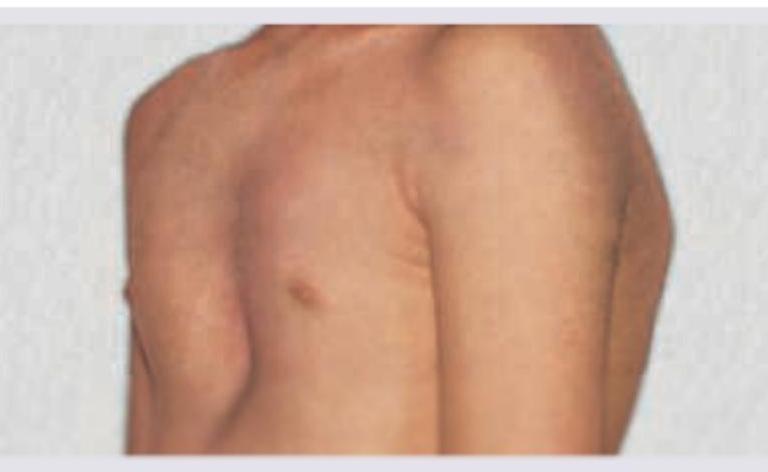 Image for question 61