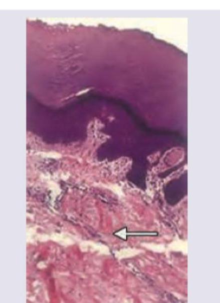 Image for question 166