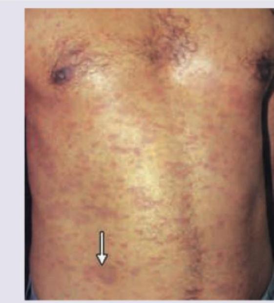 Image for question 53