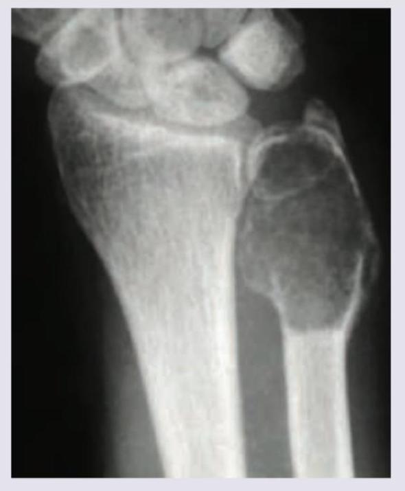 Image for question 242