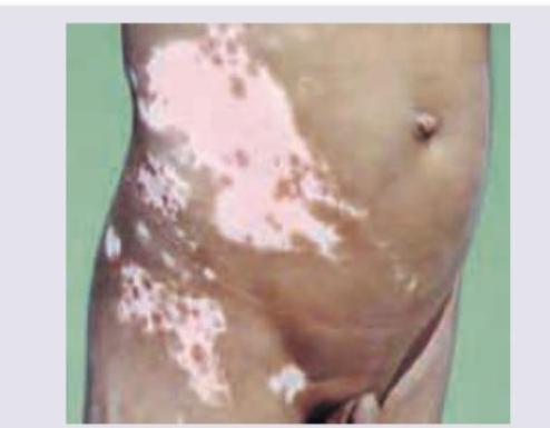 Image for question 81