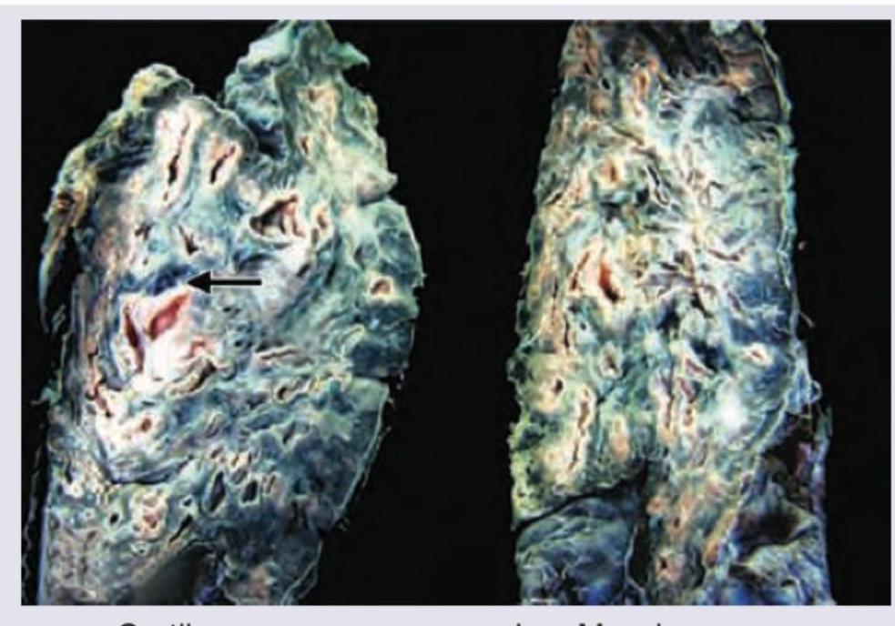 Image for question 418