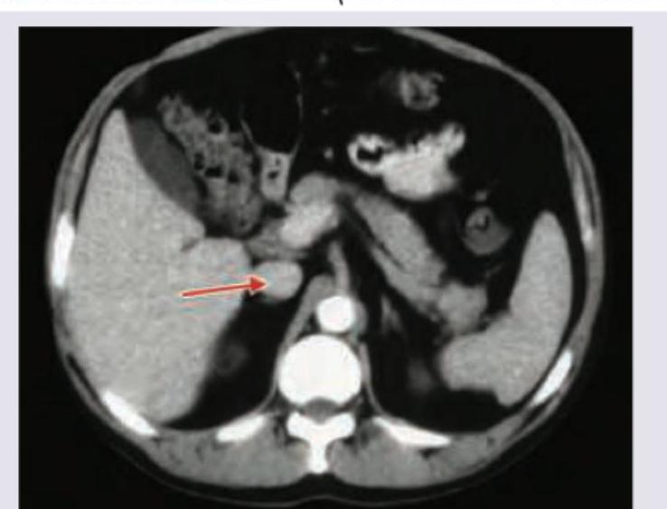 Image for question 148