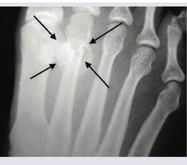 Image for question 910