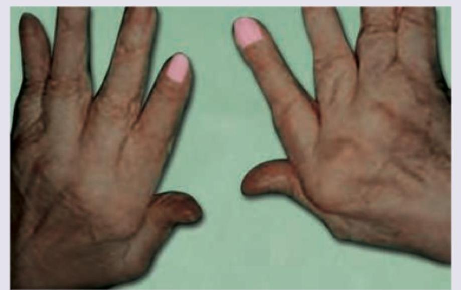 Image for question 620