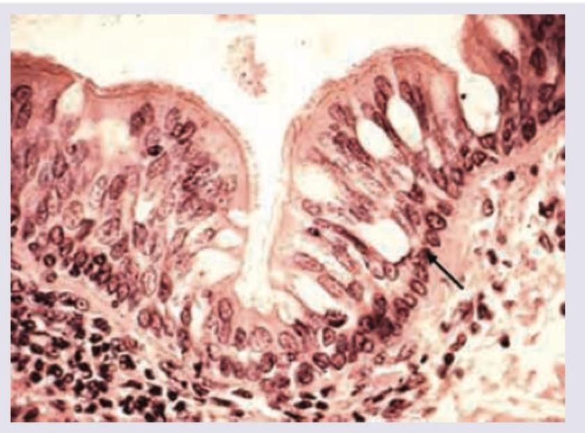 Image for question 391