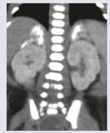 Image for question 723