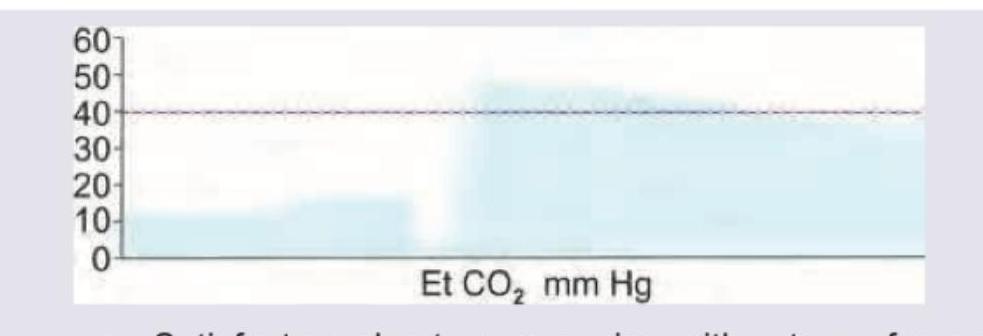 Image for question 287