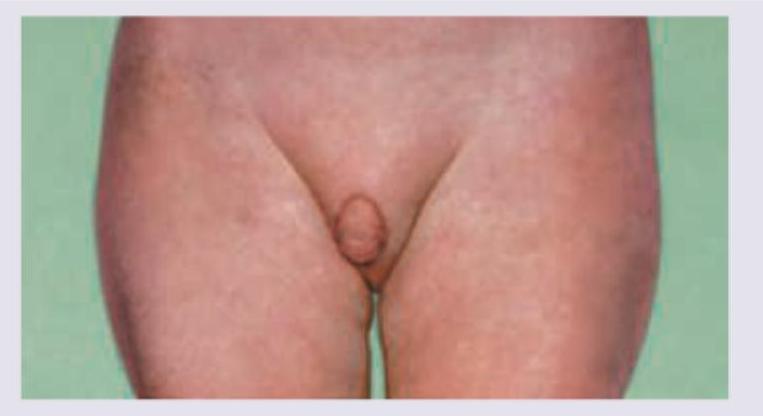 Image for question 254