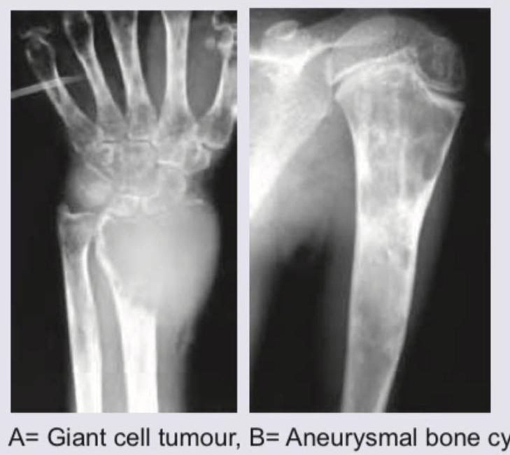 Image for question 263
