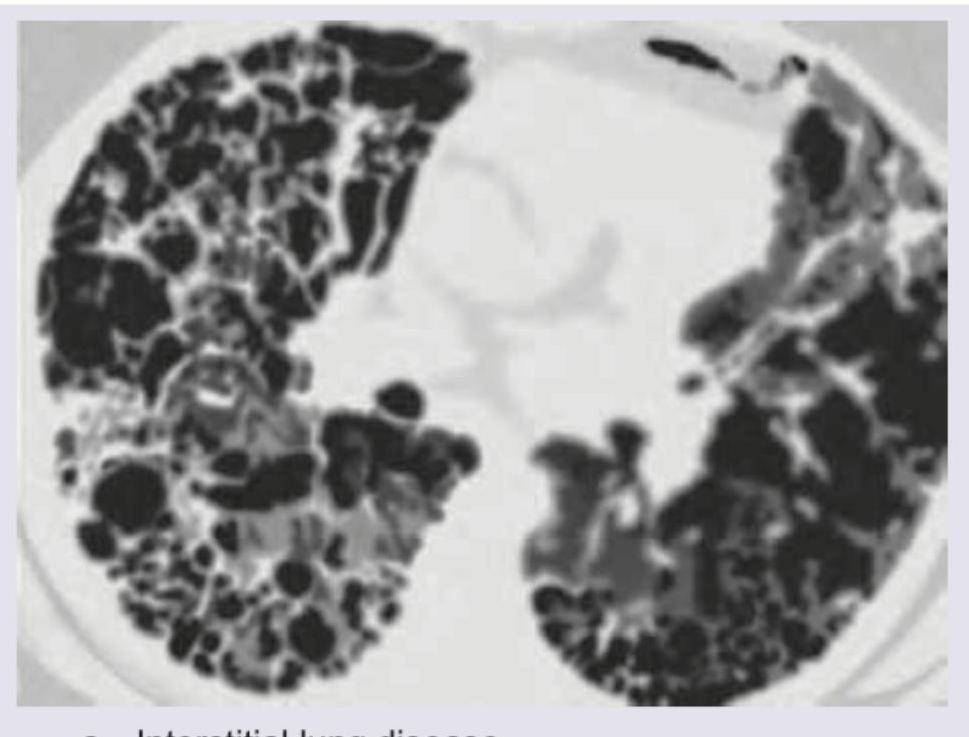 Image for question 374