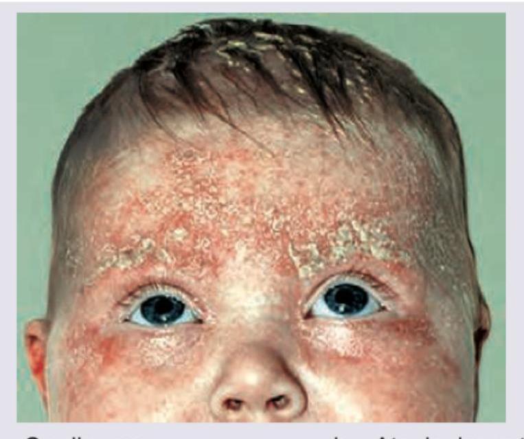 Image for question 77