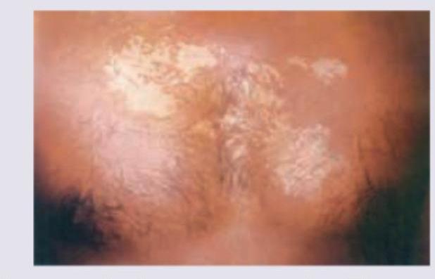 Image for question 107