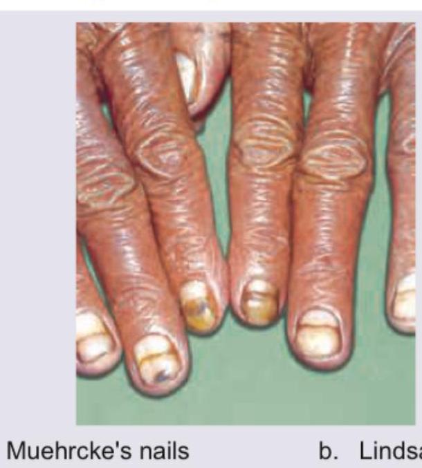 Image for question 154