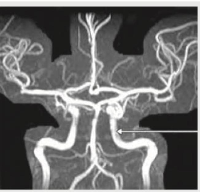 Image for question 373