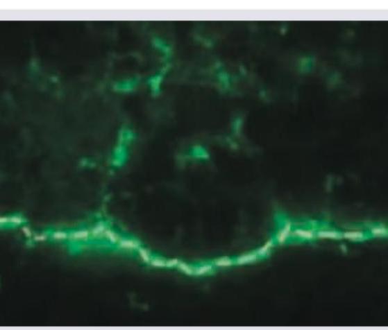 Image for question 161