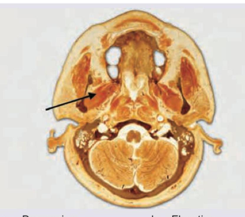 Image for question 58