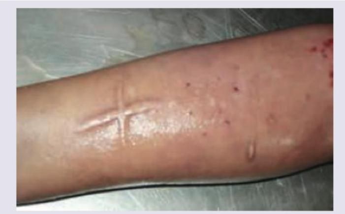 Image for question 509