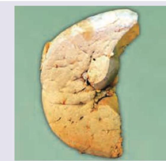 Image for question 358