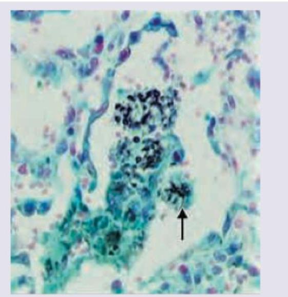 Image for question 281