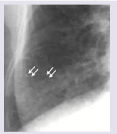 Image for question 378