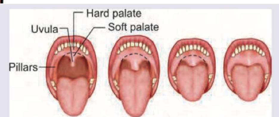 Image for question 106