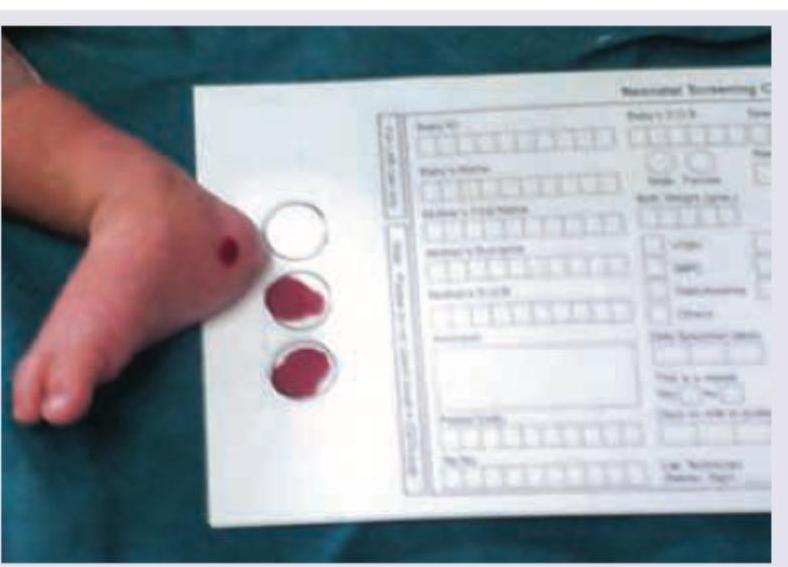 Image for question 737