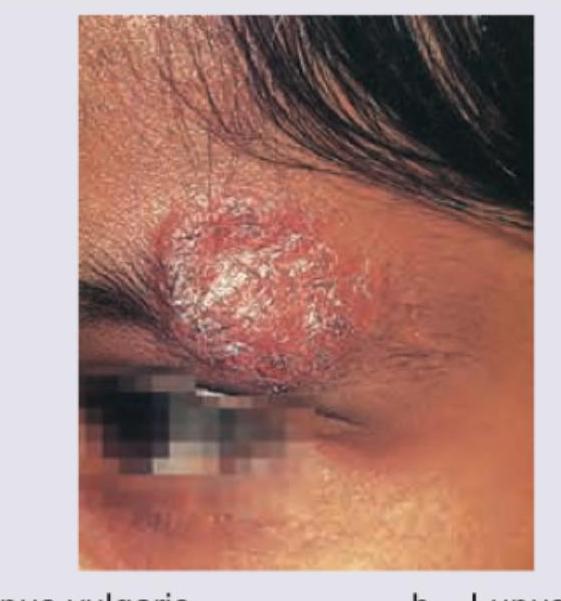 Image for question 175