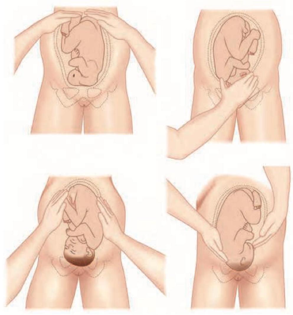 Image for question 829