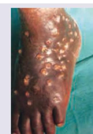 Image for question 106