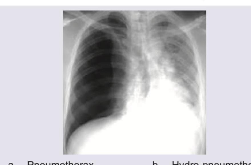 Image for question 4