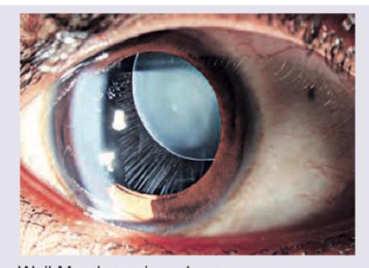 Image for question 200