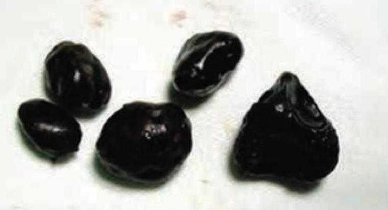 Image for question 354