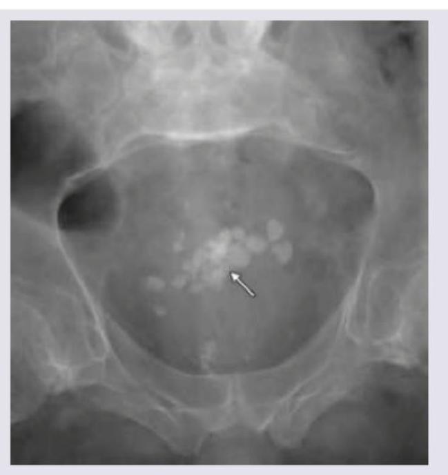 Image for question 543