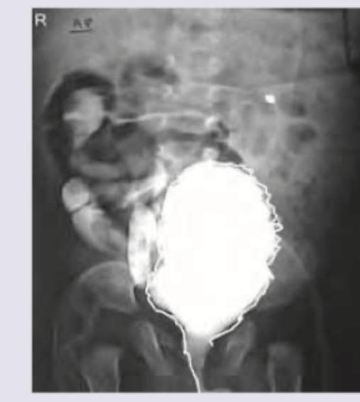 Image for question 183