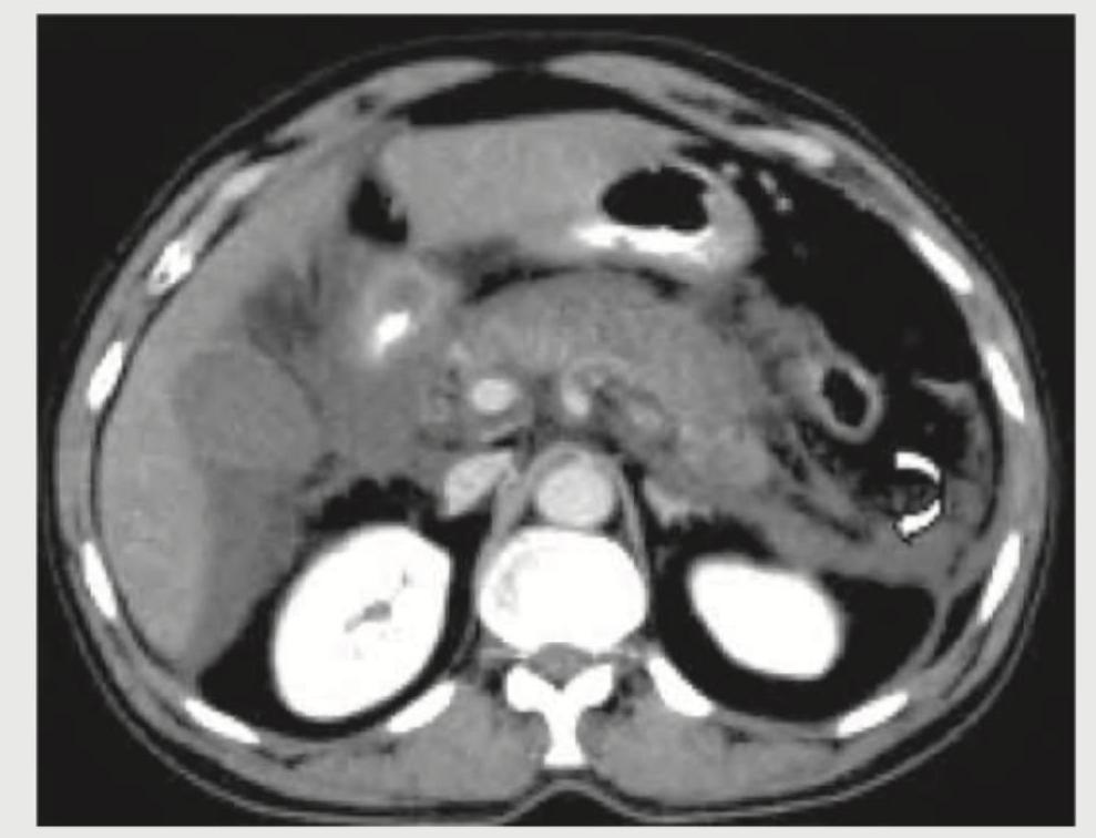 Image for question 554