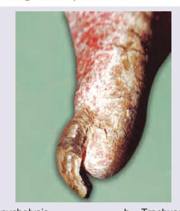 Image for question 71