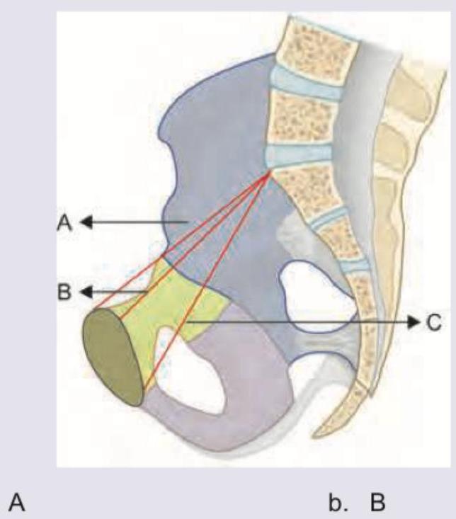 Image for question 847