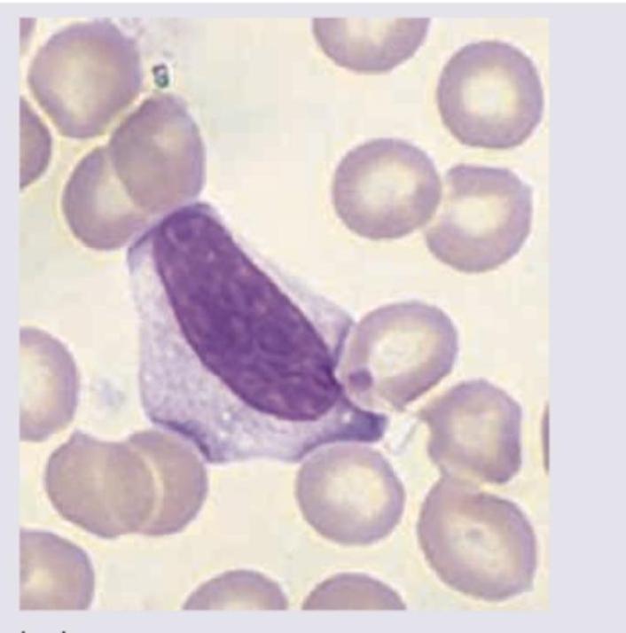 Image for question 361