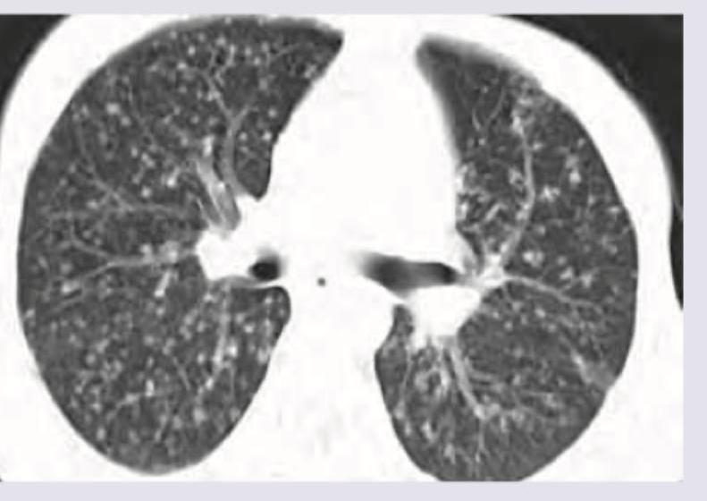 Image for question 134