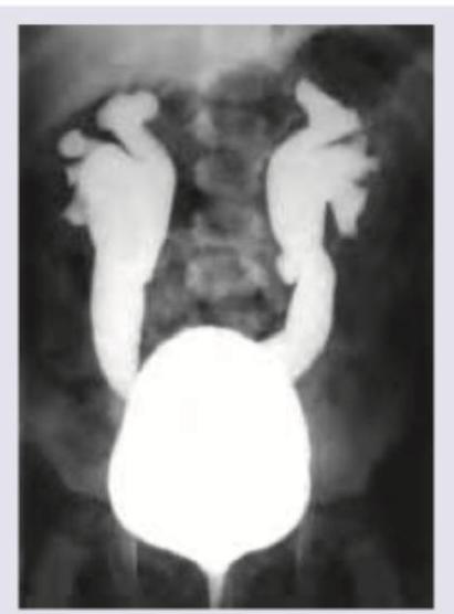 Image for question 544