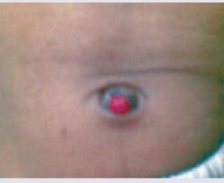 Image for question 30