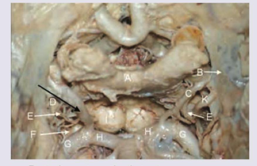 Image for question 360