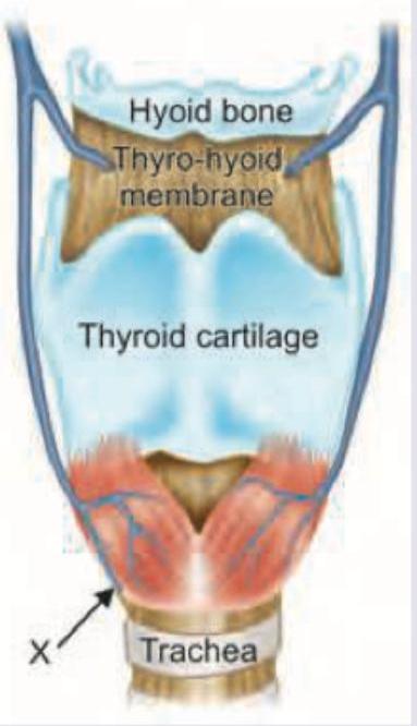 Image for question 350
