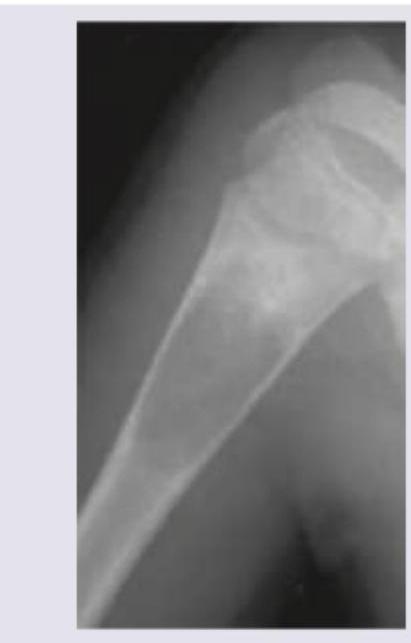 Image for question 246