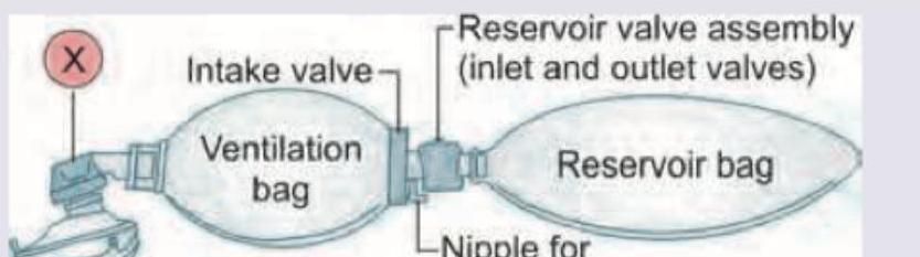Image for question 302
